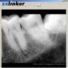 LK-C64 Oui Détecteur de rayons X dentaire Biotech Dental Digital